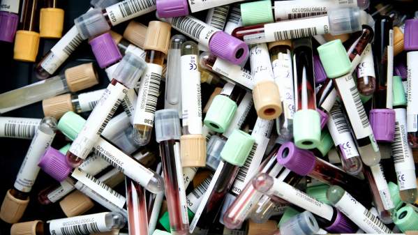 A selection of test tubes filled with blood samples