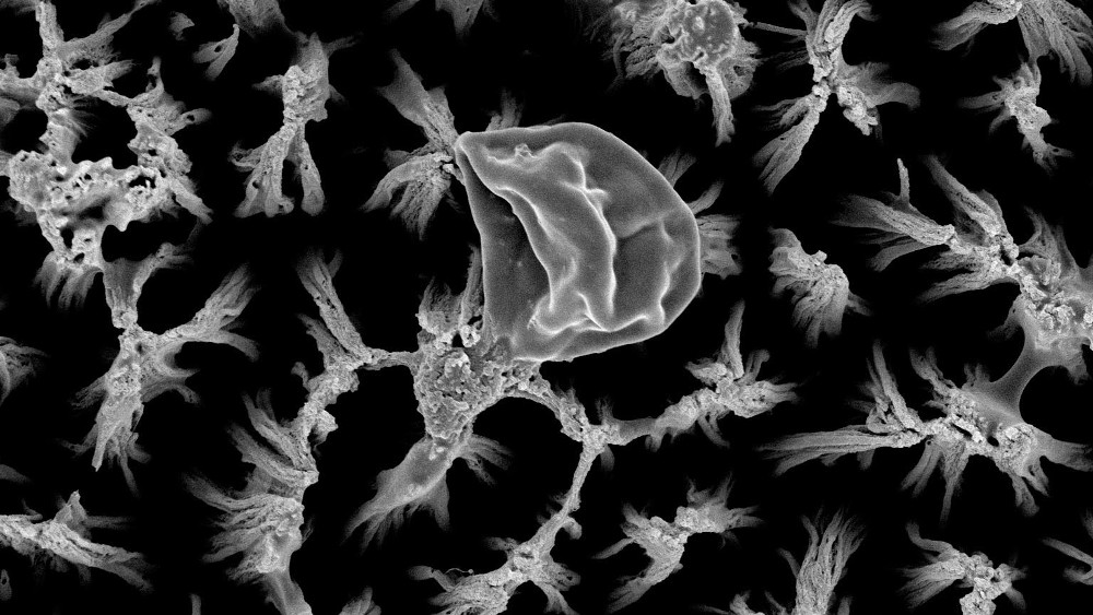 RMIT Candida top view