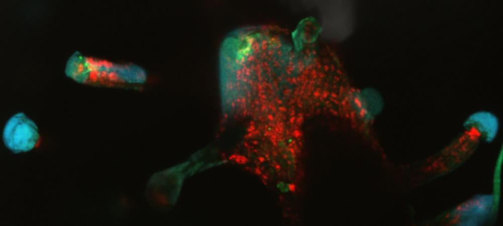 Fluorescence of Cannabis sativa L. including trichomes, the fine stalked glandular outgrowths located on female flowers that hold resin containing the plants essential oils.