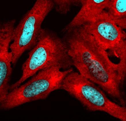 a compilation of U2OS cells undergoing treatments that create stressful cell conditions. In the images, we have oxidative and heat stresses. In response, cells enable the formation of biomolecular condensates known as stress granules to sequester RNA and translational machinery.