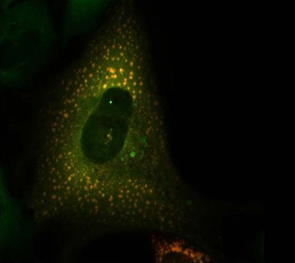 Membrane-less organelles and GFP-G3BP1 activation