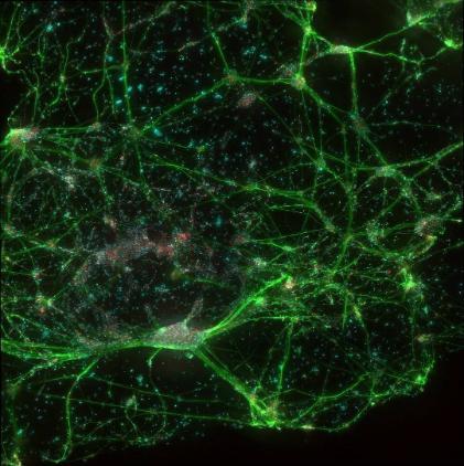 Cells showing peripheral sensory nerves