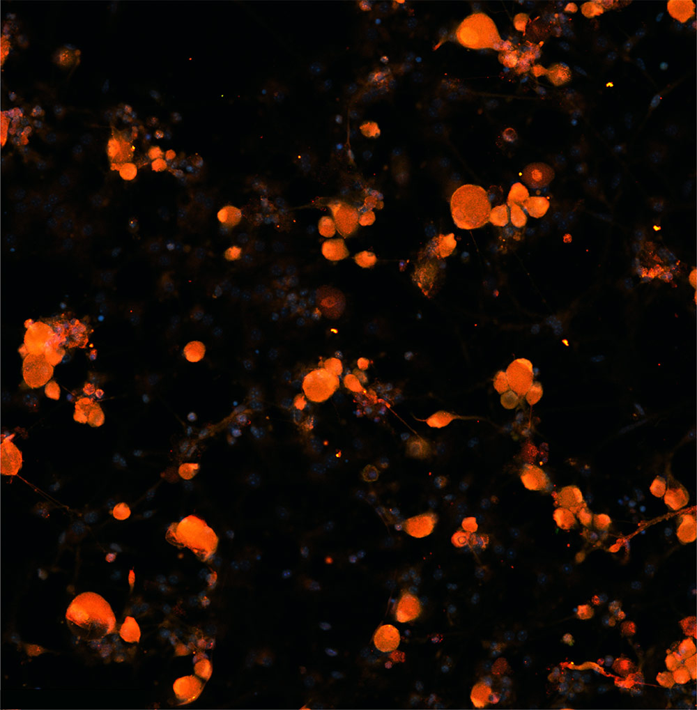effective coupling of GIRK2 ion channel and GABABR