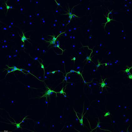 Mouse hippocampal neurons are derived from the hippocampi of normal embryonic mouse by standardized methods and form complex neurite network in one week.