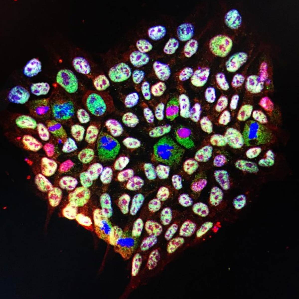 colony of iPSCs that has been stained for different transcription factors that drive their pluripotent state