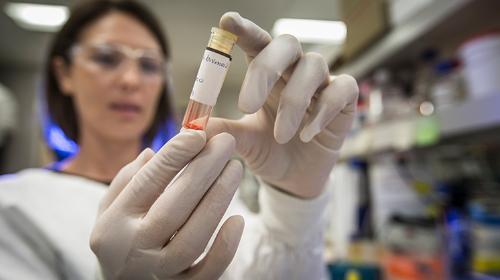 UOW medical researcher holds a vial wearing gloves